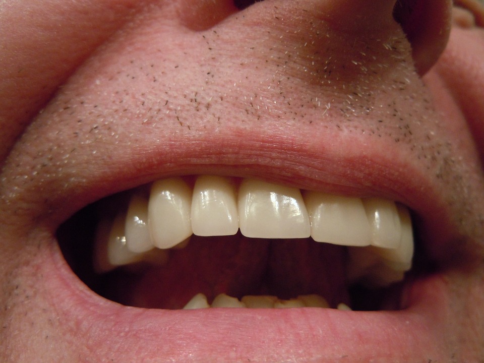 Cosmetic dentist Christchurch, Dental implants Christchurch
