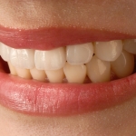 Cosmetic Dentists Christchurch. Cosmetic Fillings Christchurch, Cosmetic Dentists Christchurch. Smilesville Dental, Riccarton Road Christchurch.