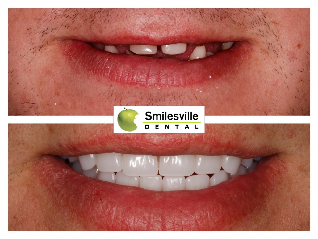 Cosmetic Dentists Christchurch. Smilesville Dental