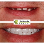 Dental Services Christchurch, Cosmetic Dentists Christchurch. Smilesville Dental, Riccarton Road Christchurch.