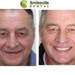 Cosmetic Dentists Christchurch. Invisalign Teeth Straightening Christchurch.