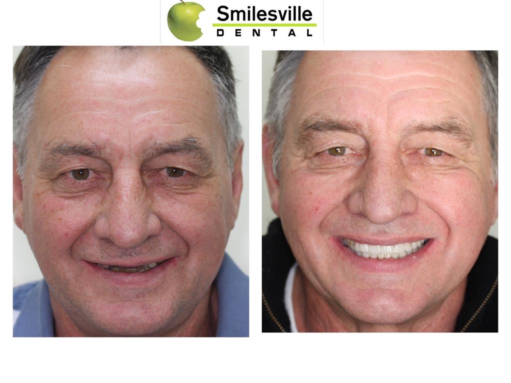 Cosmetic Dentists Christchurch. Invisalign Teeth Straightening Christchurch.